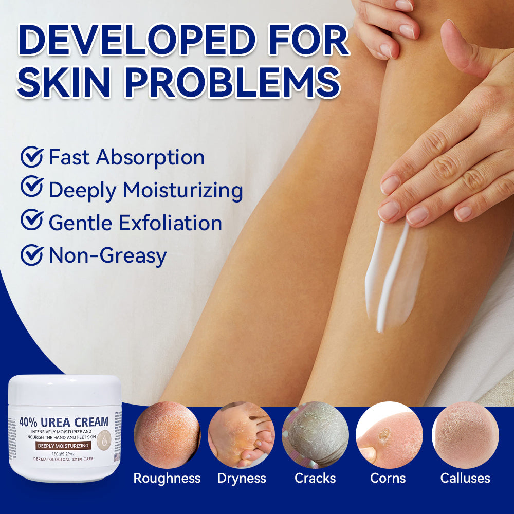 ETEB Urea Cream Moisturizing Vitamin E Cream Body Lotion Hand And Foot Care For Dry Hands And Feet
