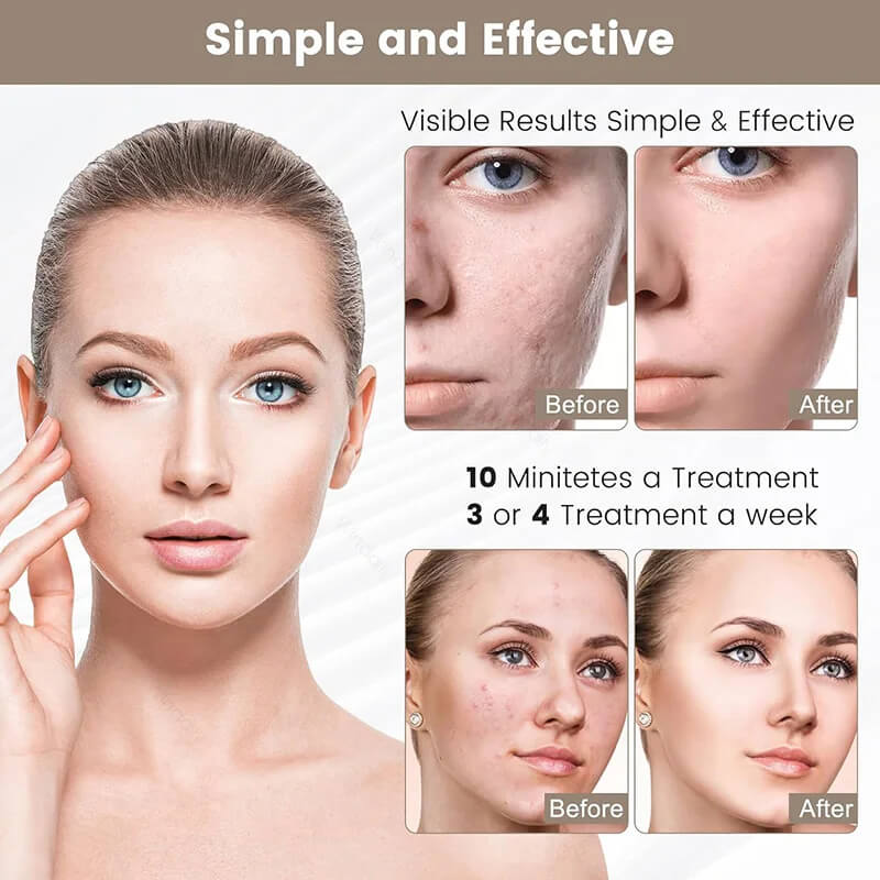 Tri Light Beauty Mask