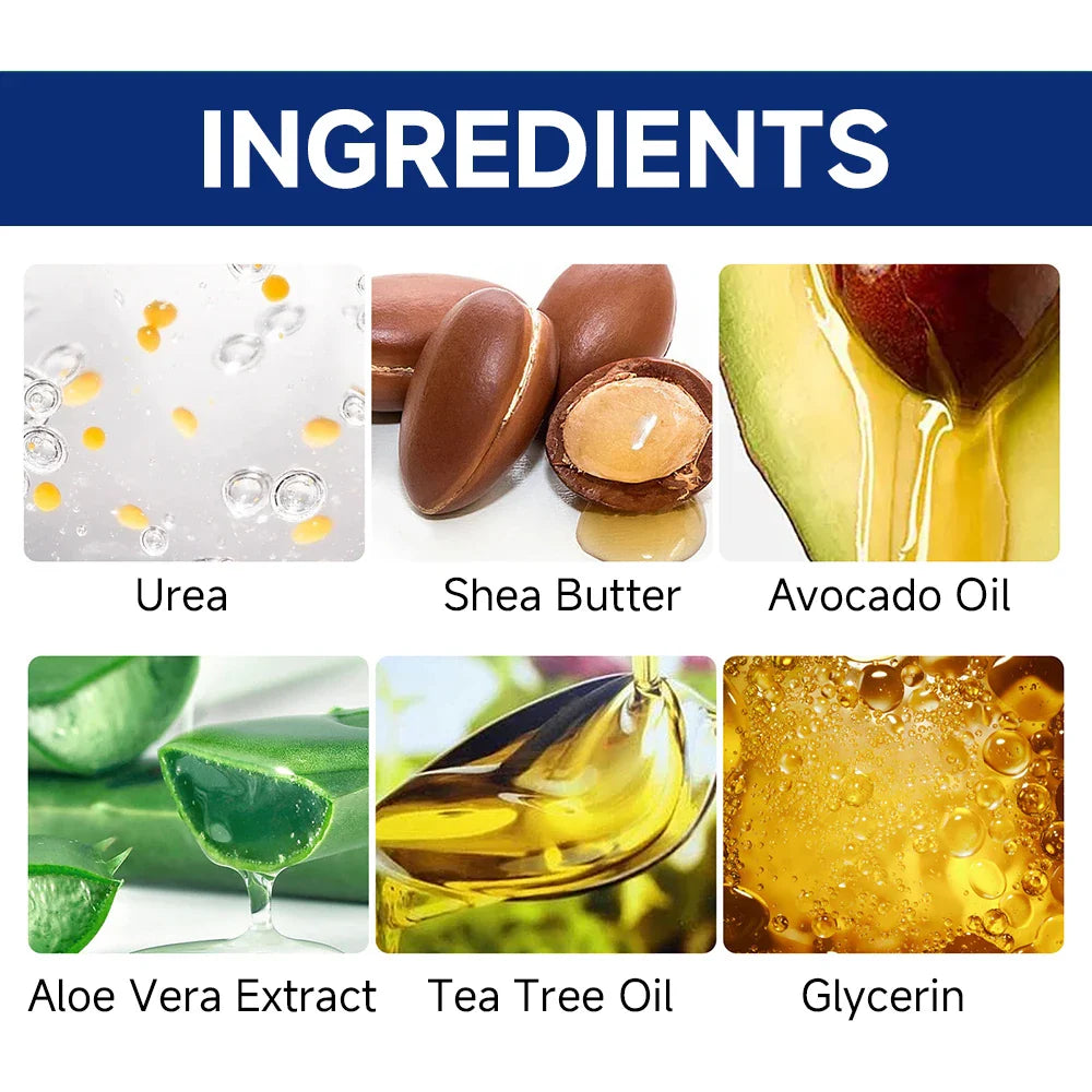 SUYARUN 60% Urea Foot Cream for Cracked Heels & Dry Skin - Intensive Moisturizing Treatment, Callus Remover, Diabetic Foot Care.